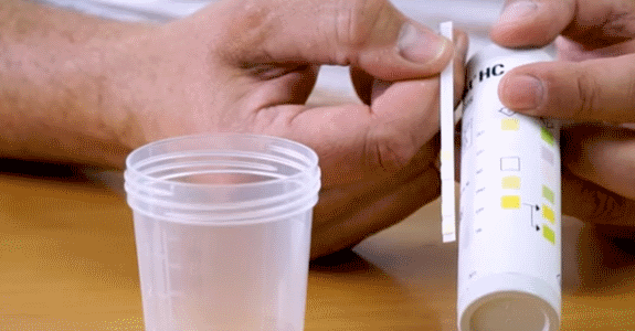 Goodbye UTI: Urine Test Strips for Diagnosis at Home